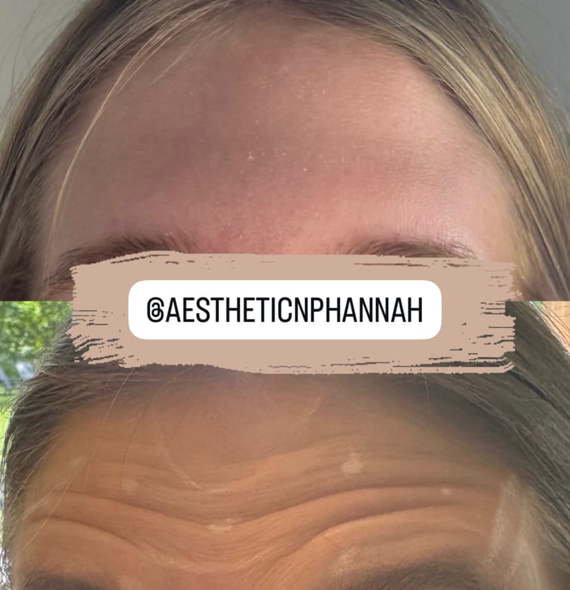Hannah W